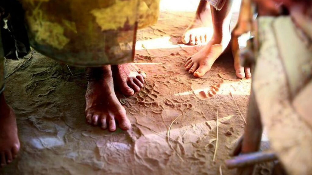 Mycetoma-a-neglected-disease-affecting-thousands-of-people.jpg