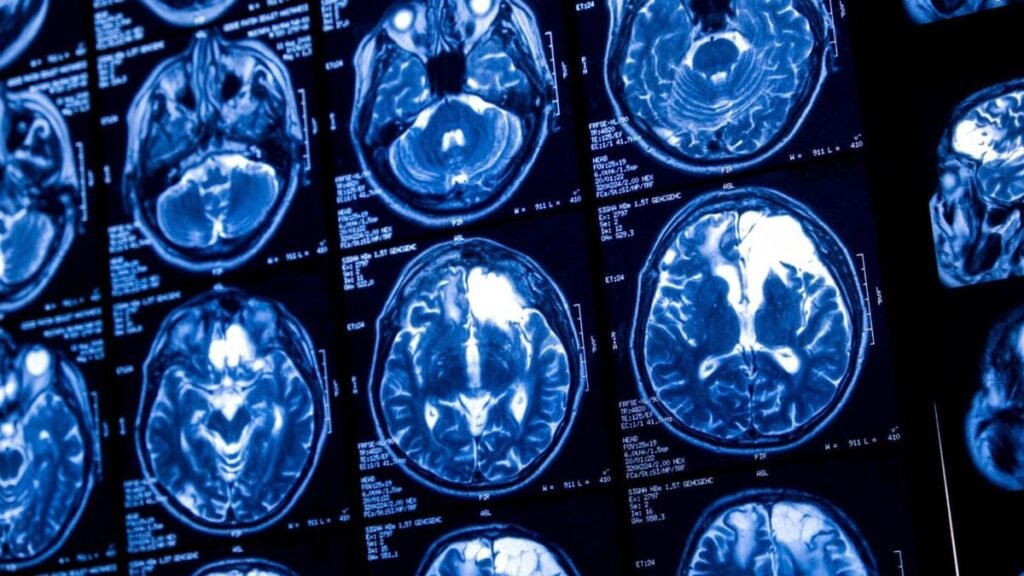 brainscan-1200x675.jpg
