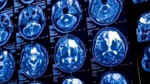brainscan-1200x675.jpg